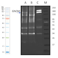 GN | Gnom in the group Antibodies Plant/Algal  / Developmental Biology / Signal transduction at Agrisera AB (Antibodies for research) (AS16 3980)